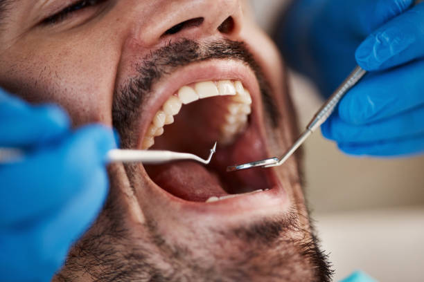 Best Emergency Cosmetic Dentistry in Mango, FL