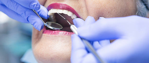 Best Emergency Dentist for Knocked-Out Tooth in Mango, FL